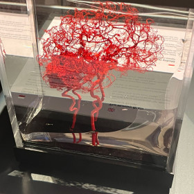 Układ krwionośny mózgu